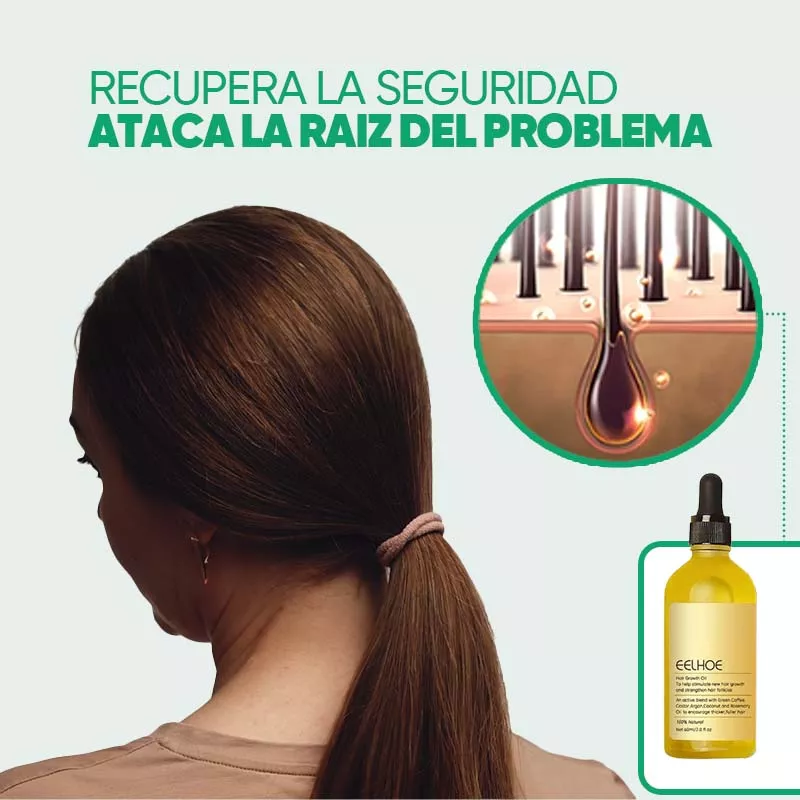 Aceite Natural para el Crecimiento del Cabello Eelhoe - Image 3